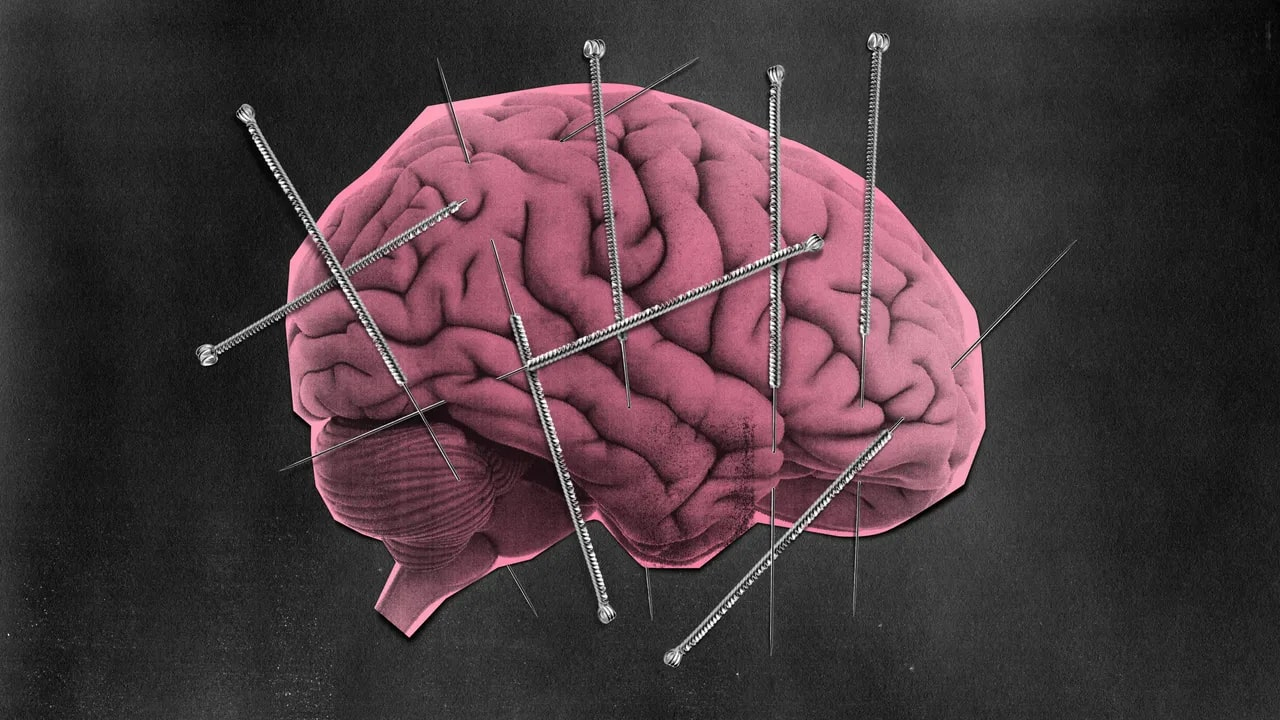 Etkili Bir Migren Tedavisi Aslında Modern Tıbbın Çok Öncesine Dayanıyor